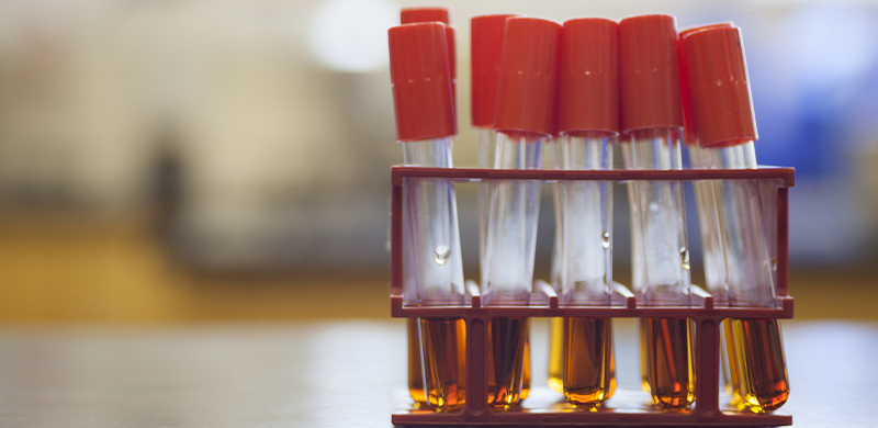 tubes of cell broth